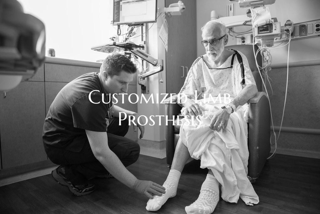Customized Limb Prosthesis